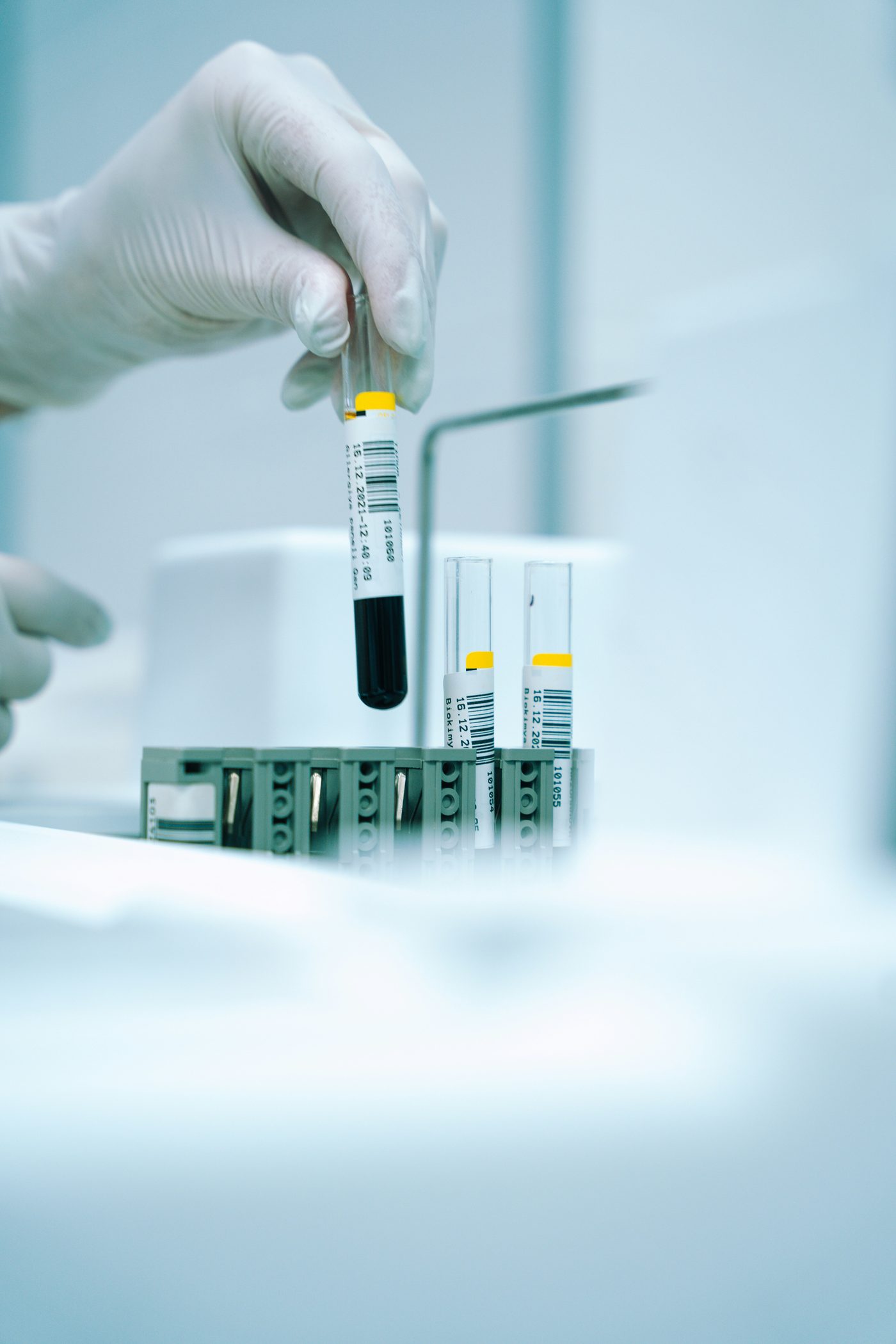 Wellness lab blood draw tubes at MediCert Pro Lab